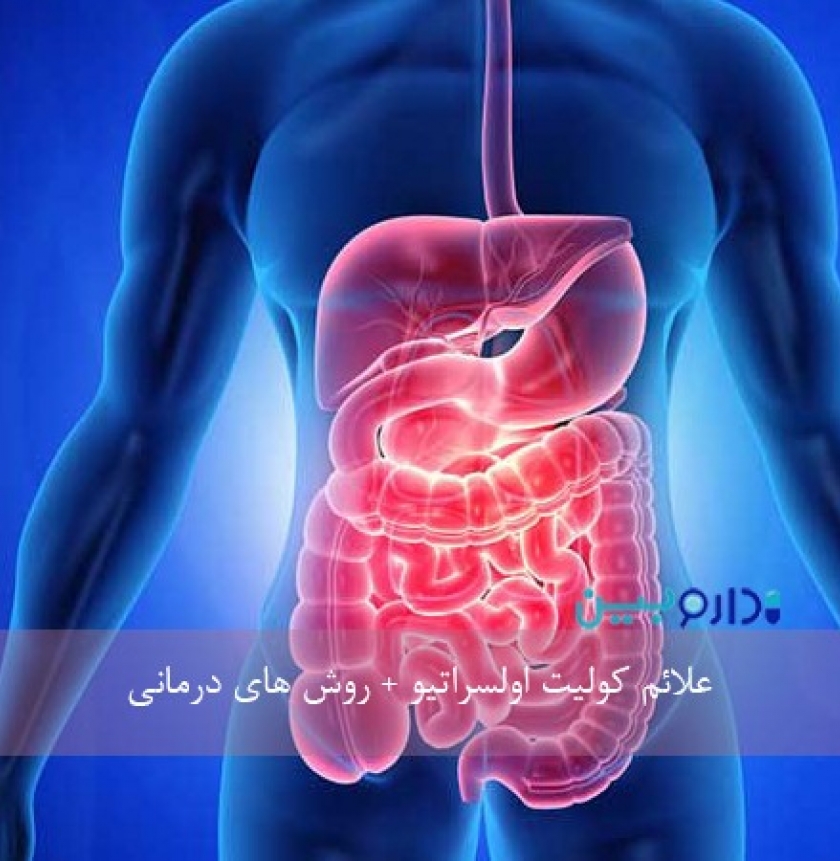 کولیت روده یا کولیت اولسراتیو چیست