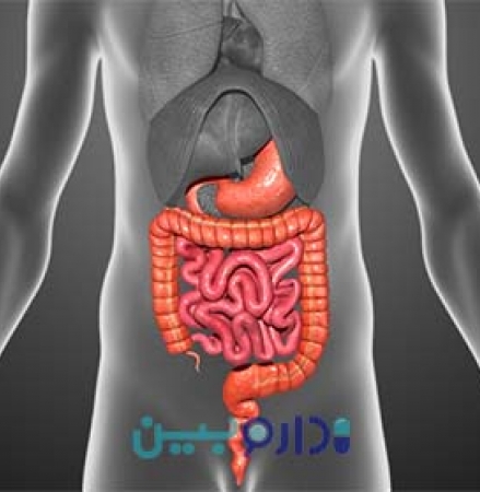 یبوست چیست