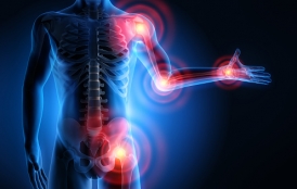 arthritis