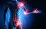 arthritis