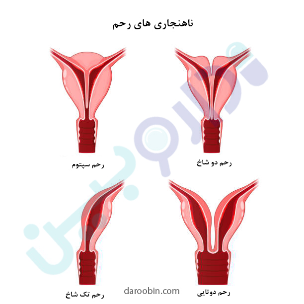 بیماری های رحم