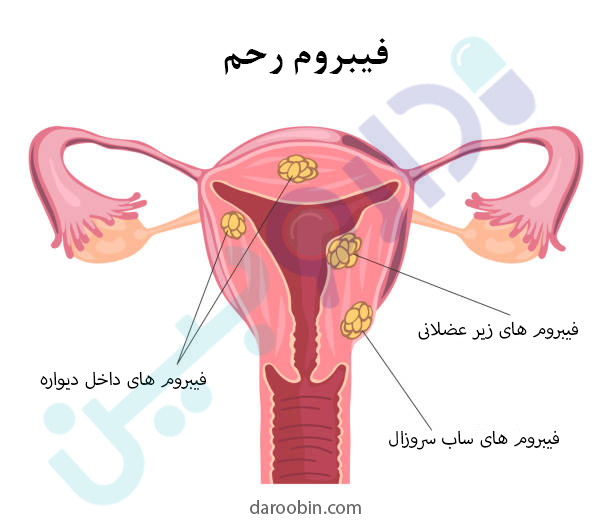 بیماری های رحم