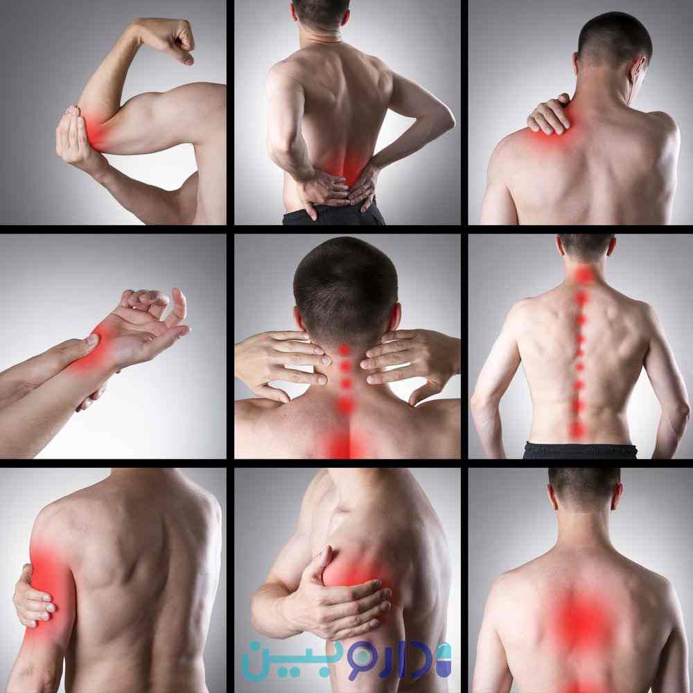 نقاط درگیر با فیبرومیالژیا