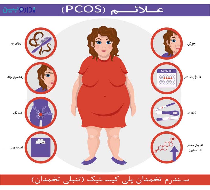 علائم تنبلی تخمدان